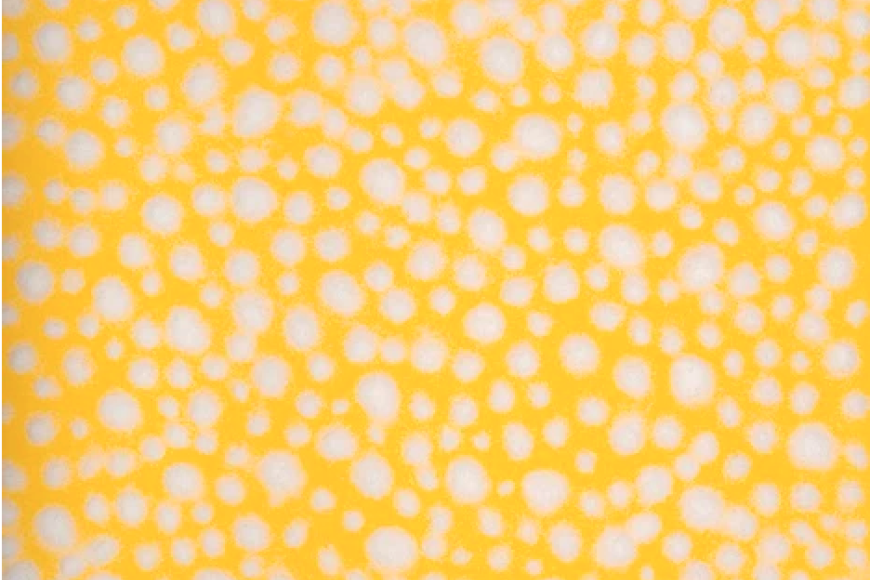 A yellow pattern of interconnected circles and oblongs, reminiscent of fatty tissue.